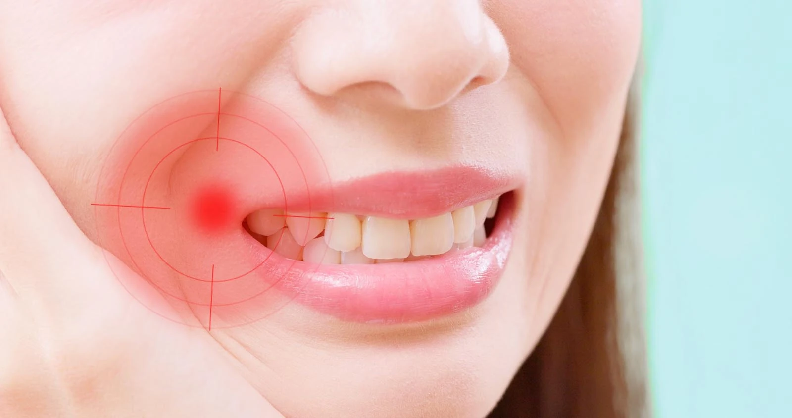 Bleeding From Mouth